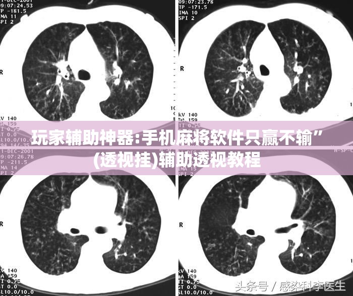 玩家辅助神器:手机麻将软件只赢不输	”(透视挂)辅助透视教程