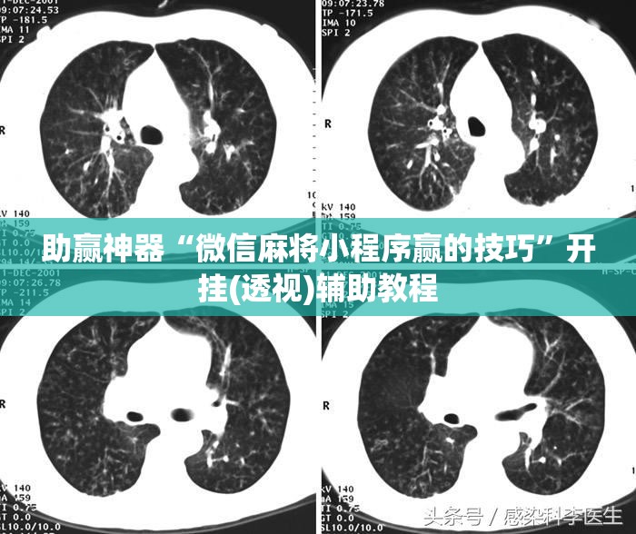 助赢神器“微信麻将小程序赢的技巧”开挂(透视)辅助教程