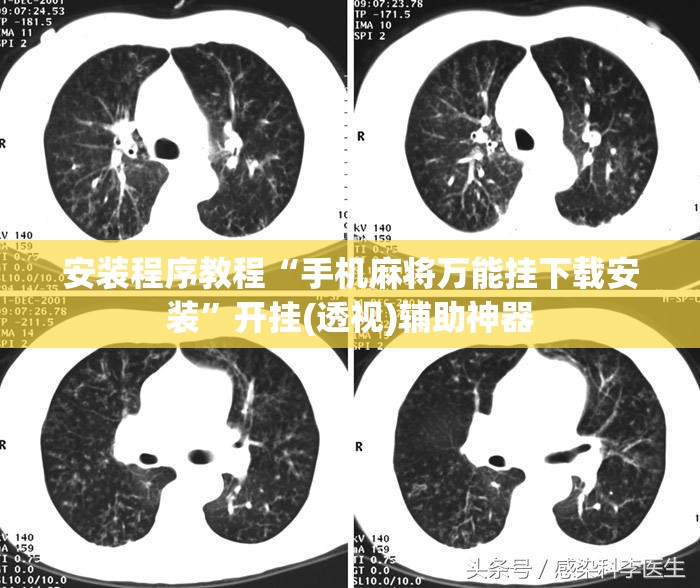 安装程序教程“手机麻将万能挂下载安装”开挂(透视)辅助神器
