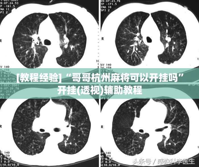 [教程经验]“哥哥杭州麻将可以开挂吗	”开挂(透视)辅助教程
