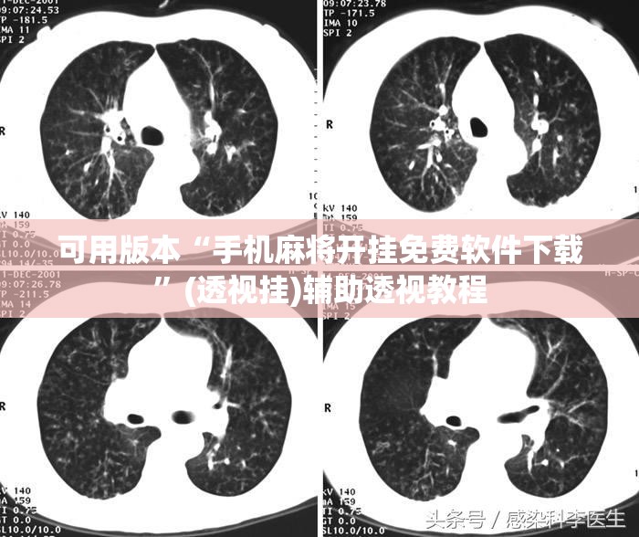 可用版本“手机麻将开挂免费软件下载”(透视挂)辅助透视教程