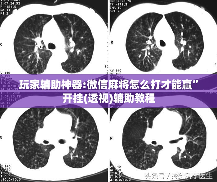 玩家辅助神器:微信麻将怎么打才能赢	”开挂(透视)辅助教程