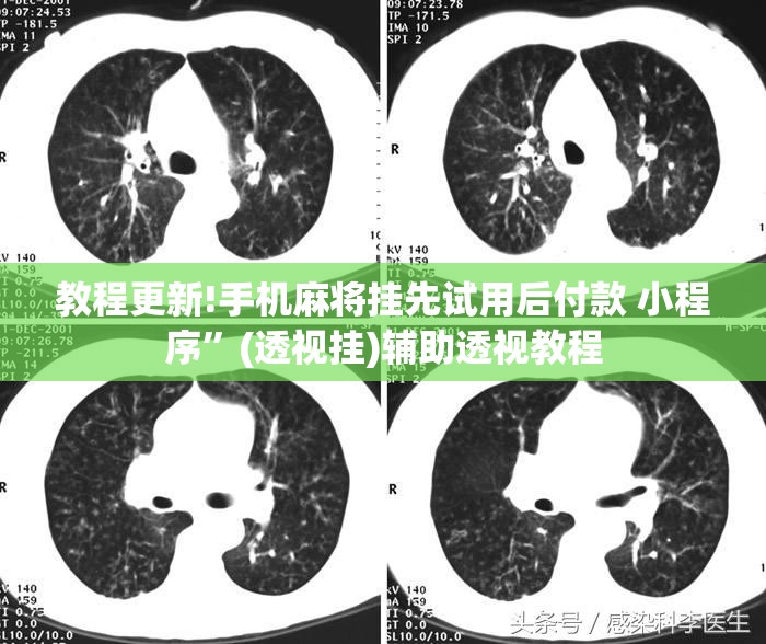 教程更新!手机麻将挂先试用后付款 小程序”(透视挂)辅助透视教程