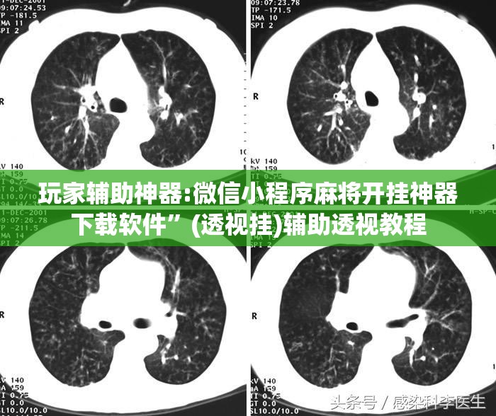 玩家辅助神器:微信小程序麻将开挂神器下载软件	”(透视挂)辅助透视教程