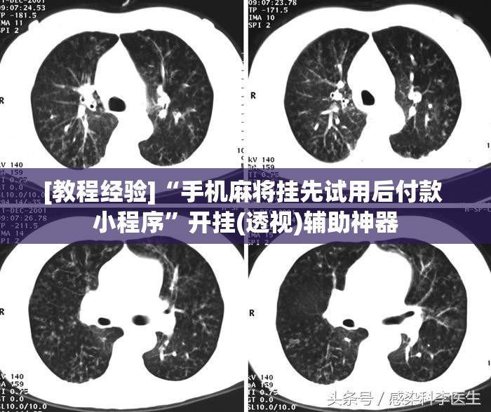 [教程经验]“手机麻将挂先试用后付款 小程序”开挂(透视)辅助神器