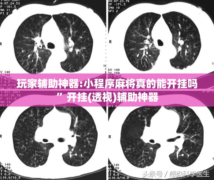 玩家辅助神器:小程序麻将真的能开挂吗”开挂(透视)辅助神器