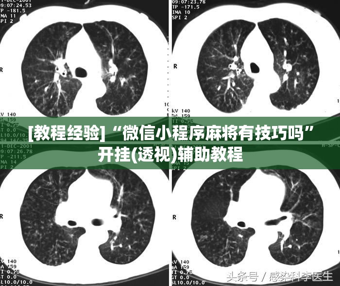 [教程经验]“微信小程序麻将有技巧吗	”开挂(透视)辅助教程