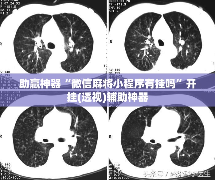 助赢神器“微信麻将小程序有挂吗	”开挂(透视)辅助神器
