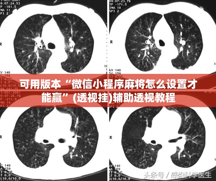 可用版本“微信小程序麻将怎么设置才能赢”(透视挂)辅助透视教程