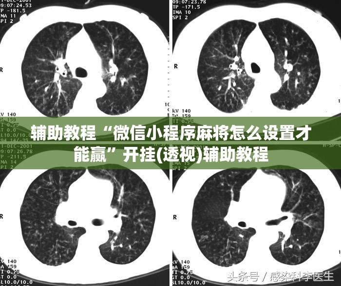 辅助教程“微信小程序麻将怎么设置才能赢”开挂(透视)辅助教程