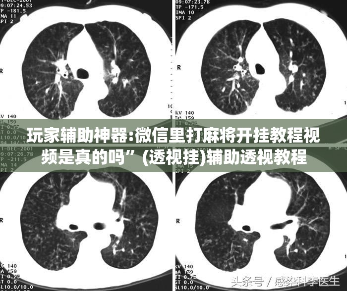 玩家辅助神器:微信里打麻将开挂教程视频是真的吗	”(透视挂)辅助透视教程