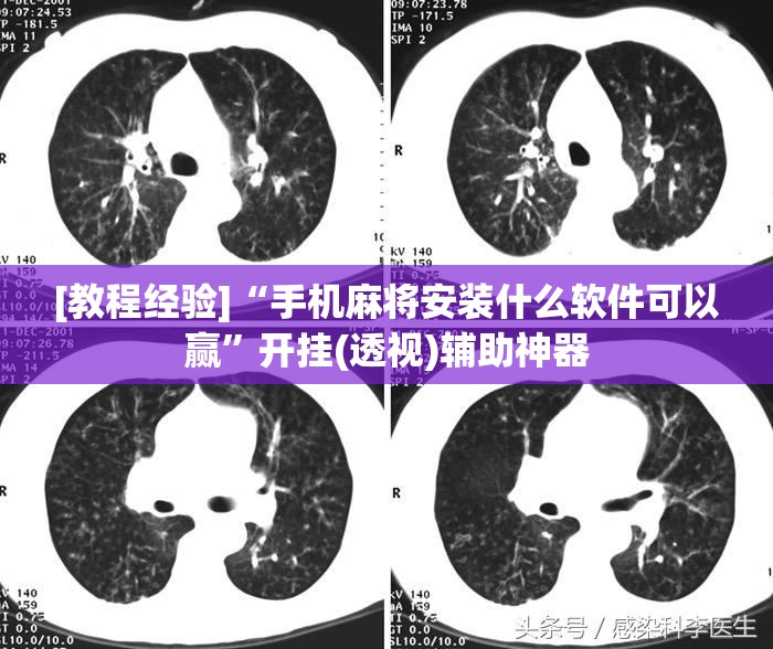 [教程经验]“手机麻将安装什么软件可以赢”开挂(透视)辅助神器