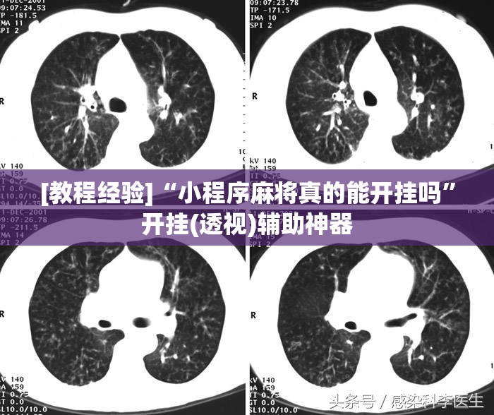 [教程经验]“小程序麻将真的能开挂吗	”开挂(透视)辅助神器