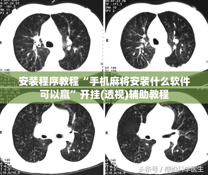 安装程序教程“手机麻将安装什么软件可以赢”开挂(透视)辅助教程