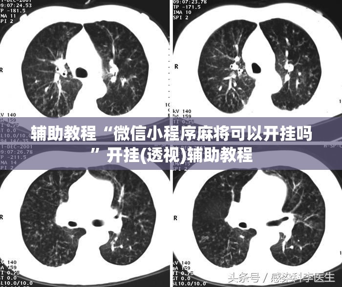 辅助教程“微信小程序麻将可以开挂吗”开挂(透视)辅助教程
